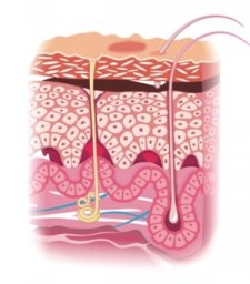 CHAFES & BEDSORES